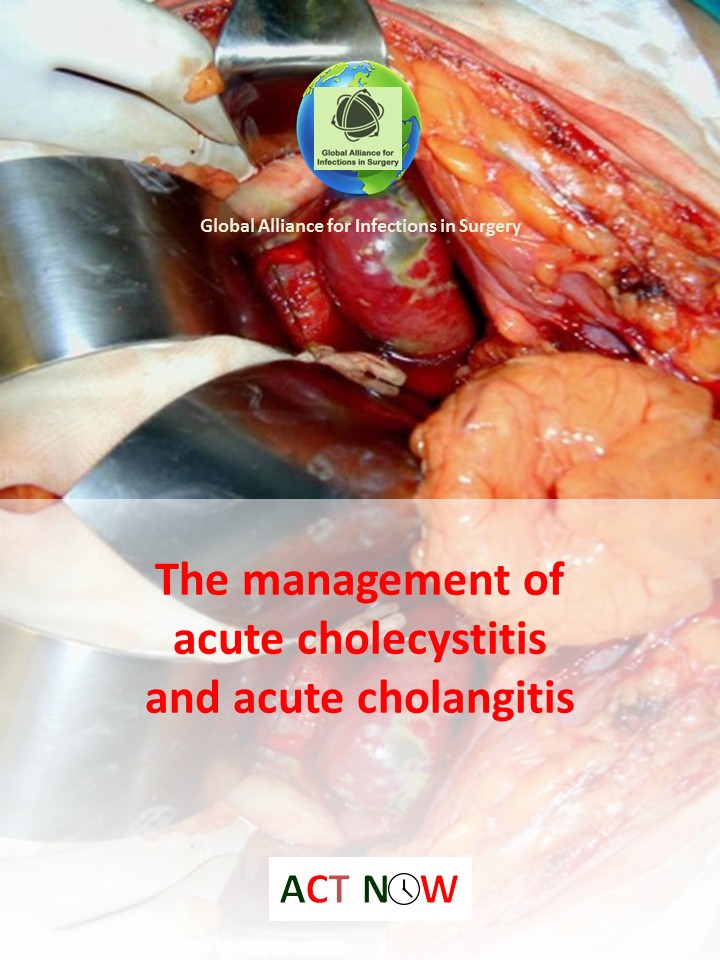 Acute cholecystitis and acute cholangitis