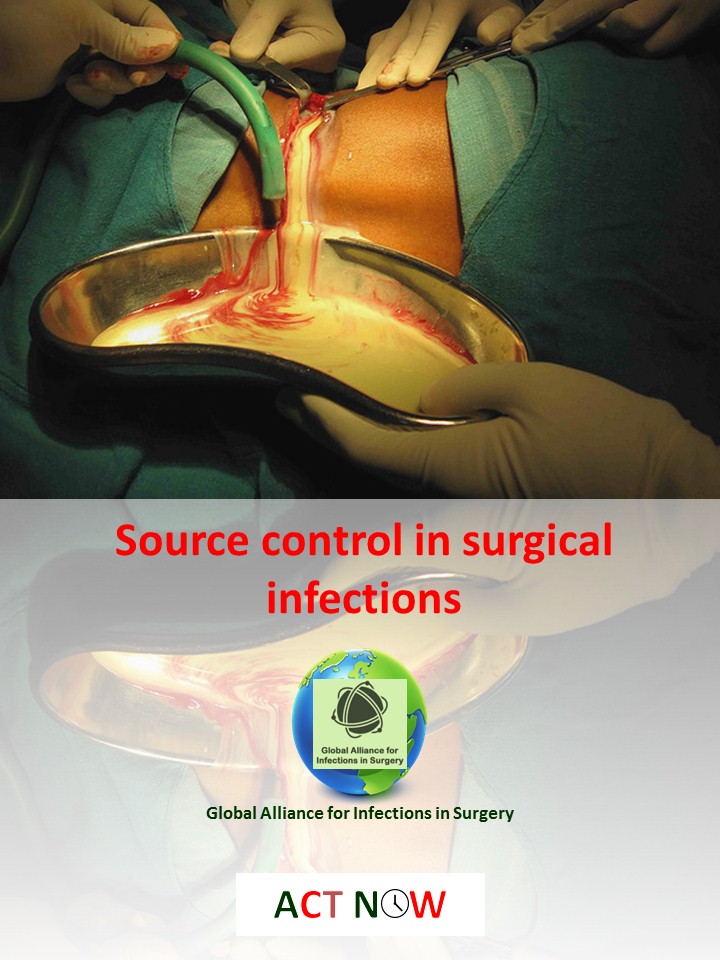 Source control in surgical infections